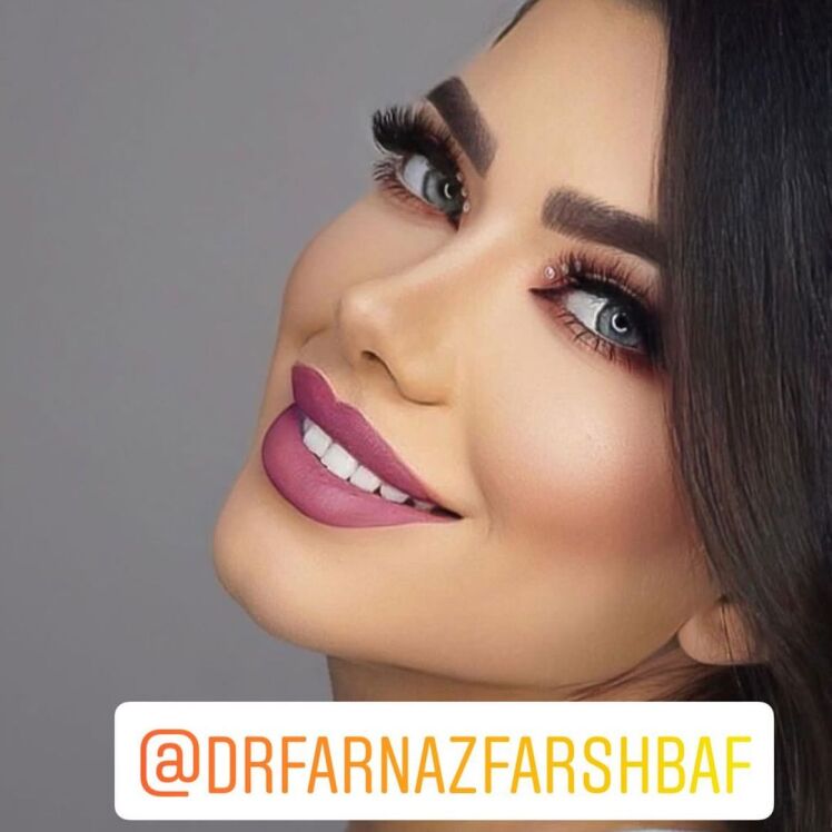 بهترین جراح بینی گوشتی